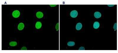 Immunofluorescence: Histone H3 [Methyl Lys9] Antibody [NBP2-59156] - HeLa cells were stained with the antibody against H3K9me1 and with DAPI. Cells were formaldehyde fixated, permeabilized with Triton X-100 and blocked with PBS containing 2.5% BSA. FigureA: cells were immunofluorescently labelled with the H3K9me1 antibody (diluted 1:200 and incubated for 1 hour at room temperature) followed by goat anti-rabbit antibody conjugated to DyLight. FigureB: staining of the nuclei with DAPI, which specifically labels DNA. Both antibody and DAPI staining are restricted to the nucleus.